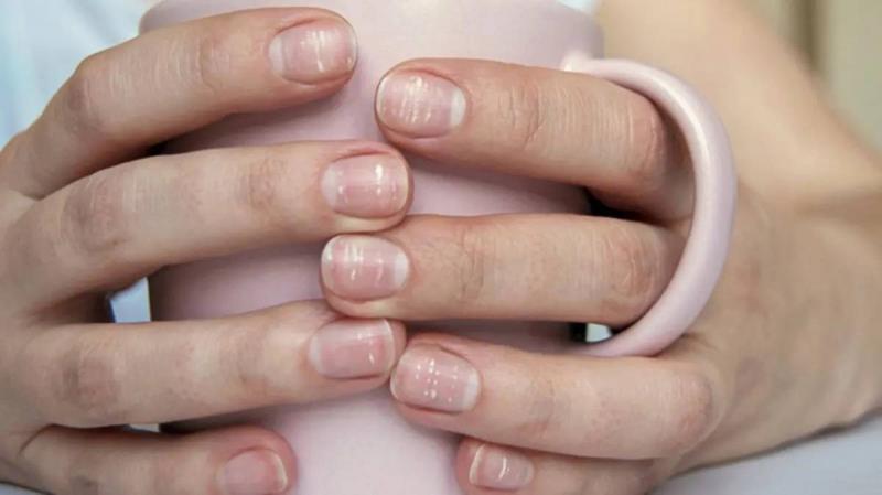 Nail Colors: What Do They Indicate?
