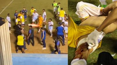 Shocking Moment: Police Officer Shoots Player During Match (Video)