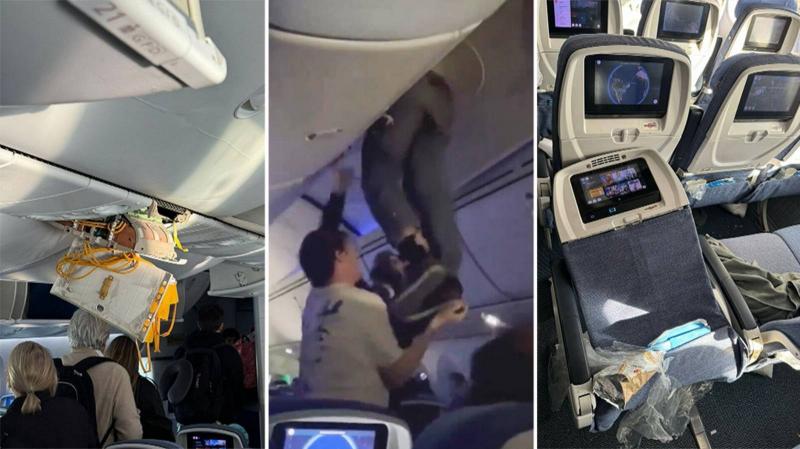 30 Passengers Injured on Plane Encountering Severe Turbulence