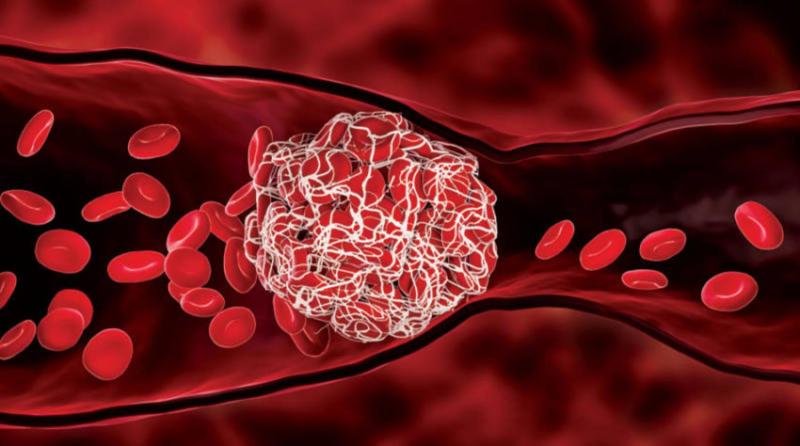 Unprecedented Achievement: Iraq Produces a Treatment that Prevents 