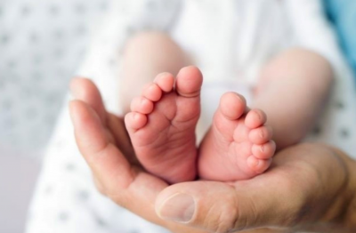 "Rare Case": Baby Born with Eight Limbs and Two Faces! (Photo)