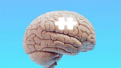 The Difference Between Alzheimer's and Dementia