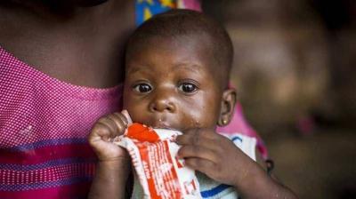 UN Issues Urgent Call to Save 30 Million Children Suffering from Severe Malnutrition