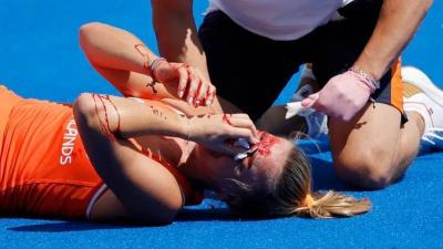 Blood Covers Dutch Player’s Face at Paris Olympics