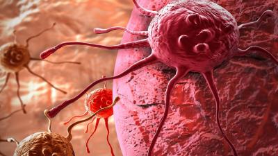 Ways to Reduce the Risk of Deadly Cancer