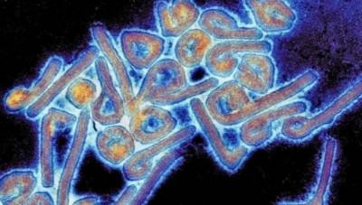 ## What is the "Marburg" Virus and How Does it Affect Humans?