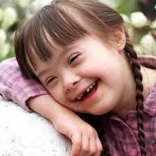 Researchers Identify Genetic Basis for Facial Changes in Down Syndrome