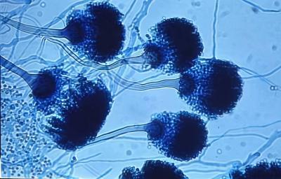 Killer Fungus Invading U.S. Lands