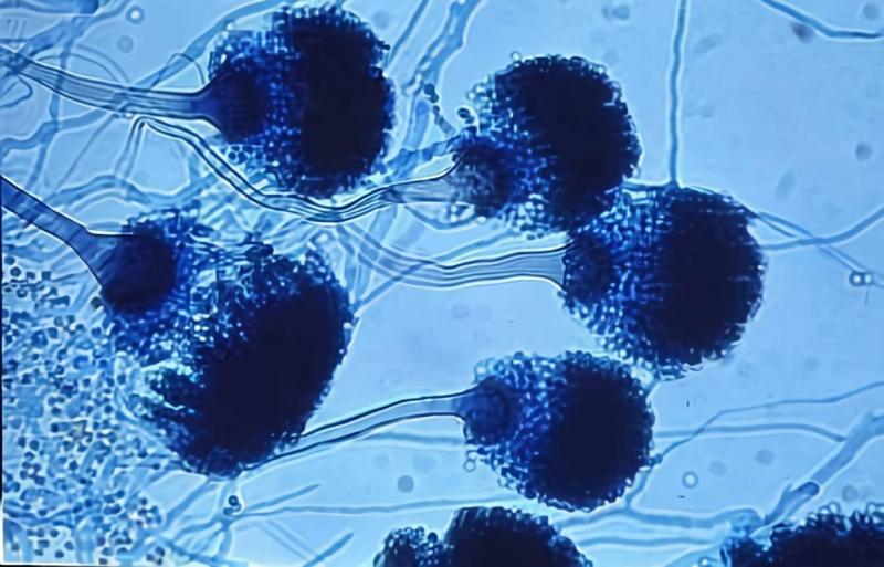 Killer Fungus Invading U.S. Lands