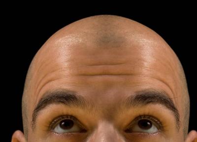 Foods that Help Combat Baldness