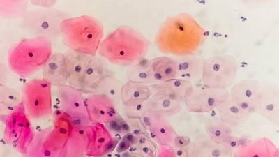 Study: One-Third of Men Worldwide Infected with STIs Believed to Affect Only Women