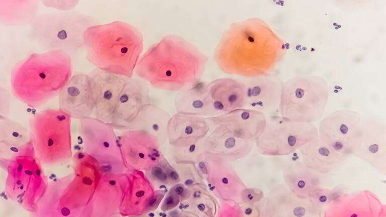 Study: One-Third of Men Worldwide Infected with STIs Believed to Affect Only Women