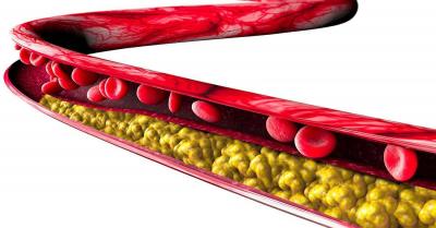 Best Fat Sources to Lower Bad Cholesterol Levels in the Blood