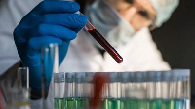 Blood Test Predicts Parkinson's Disease Before Symptoms Appear