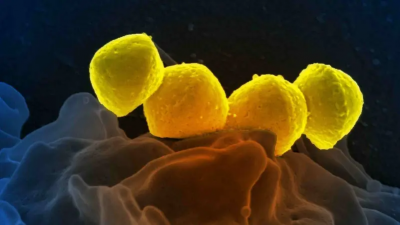 Fright from the Spread of a New Bacteria