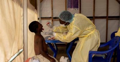 "Monkeypox" Raises Global Concerns