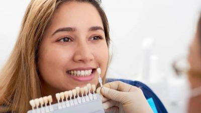 "Ceramic Veneers" for Teeth: What Do You Know About Them?