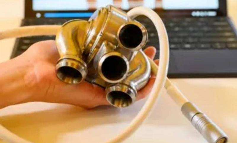 Living Patient with Titanium Mechanical Heart