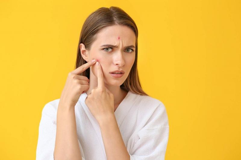 The Dangers of Popping Pimples: Learn About Them!