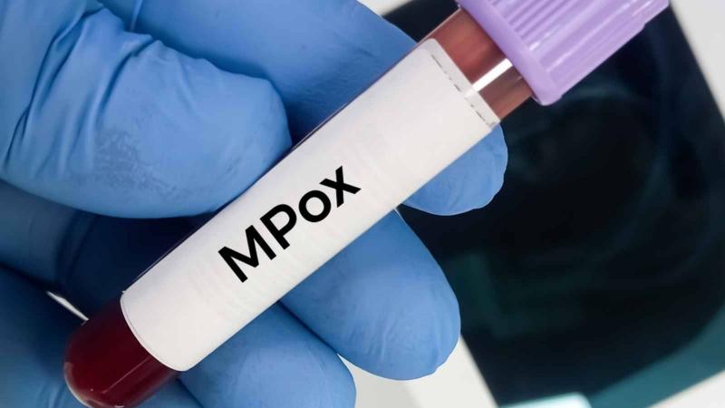 Morocco: Health Sector Alerted and Urgent Instructions for Officials