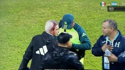لقطات صادمة... إصابة دموية لمدرب مصر السابق بسبب الجماهير (فيديو)