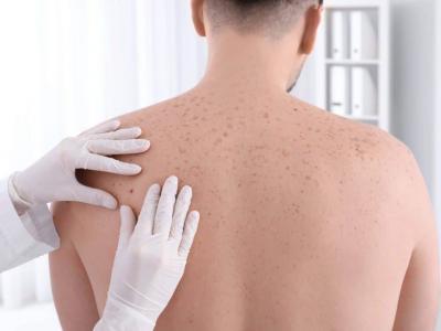 علامات لتشخيص 
