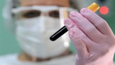 إجراء تحليل دم مرة في السنة ضروريّ.. لهذا السّبب