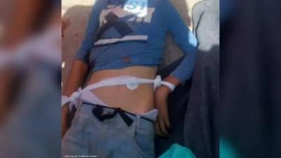 أشعلت مواقع التواصل... صورة لحزام طفل قتل بجريمة بانياس