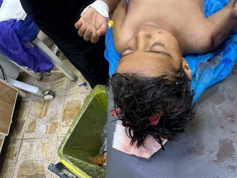 الكلاب نهشت جسده.. طفل صغير في حالة حرجة بالبصرة (صورة)