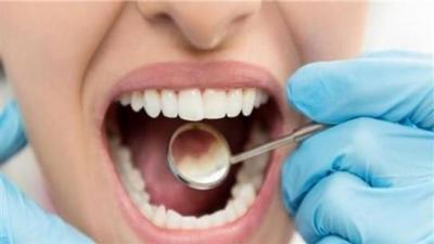علامات تدلّ على الإصابة بسرطان الفم.. لا تتجاهلوها!
