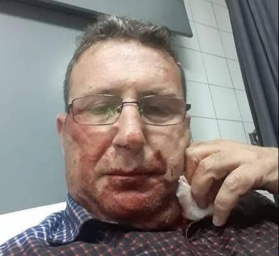 نجا بأعجوبة.. تعرّض الفنان محمد إسماعيل للطعن والنشل في الجناح ‏