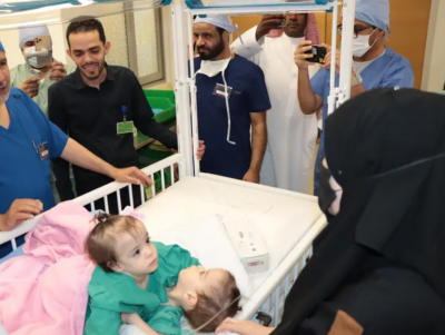 بدء عملية فصل التوأم الملتصقين السوريين سيلين وإيلين