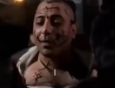 الإعتداء على مطرب سوري في حلب.. أول تعليق رسمي