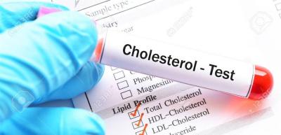 علاج جيني جديد يخفض الكوليسترول 