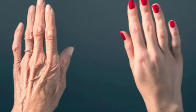 علماء يتوصلون إلى علاج أولي للشيخوخة... نجح على الفئران