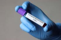 Iron deficiency and increased heart rate.