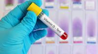 The normal level of Vitamin D in the blood The normal level of Vitamin D in the blood