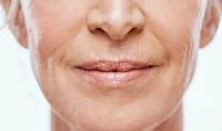 Does vitamin A reduce wrinkles? Does Vitamin A reduce wrinkles?