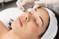 The best treatment for pigmentation in Beirut
