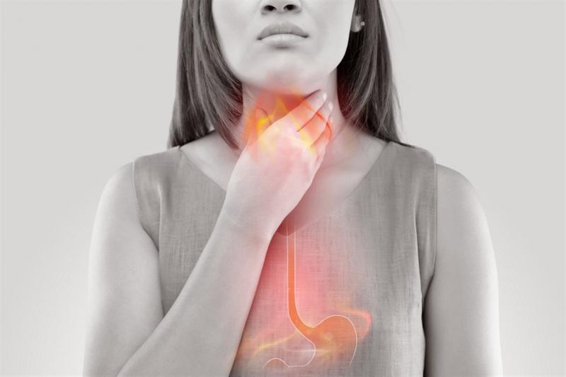 Understanding Symptoms and Causes of Acid Reflux