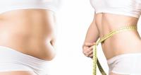 Body sculpting Body contouring