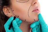 عمليات التجميل عمليات التجميل