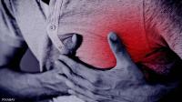 Causes of chest pain Causes of chest pain