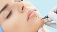 أسعار عمليات التجميل في لبنان
أسعار عمليات التجميل في لبنان