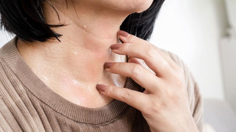 What Causes Hot Flashes in Women?