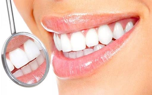 Cost of Teeth Whitening in Lebanon 2026