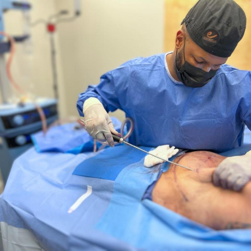 Exploring the Top Liposuction Clinics in Lebanon