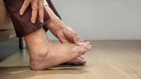 Swollen feet