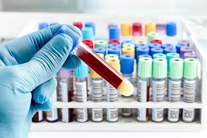 Top 5 Medical Laboratories in Lebanon