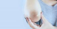 Darkening of knees and elbows Darkening of knees and elbows